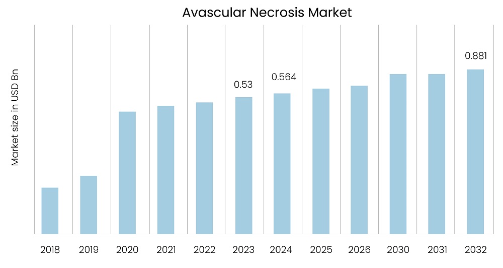 AVN Market